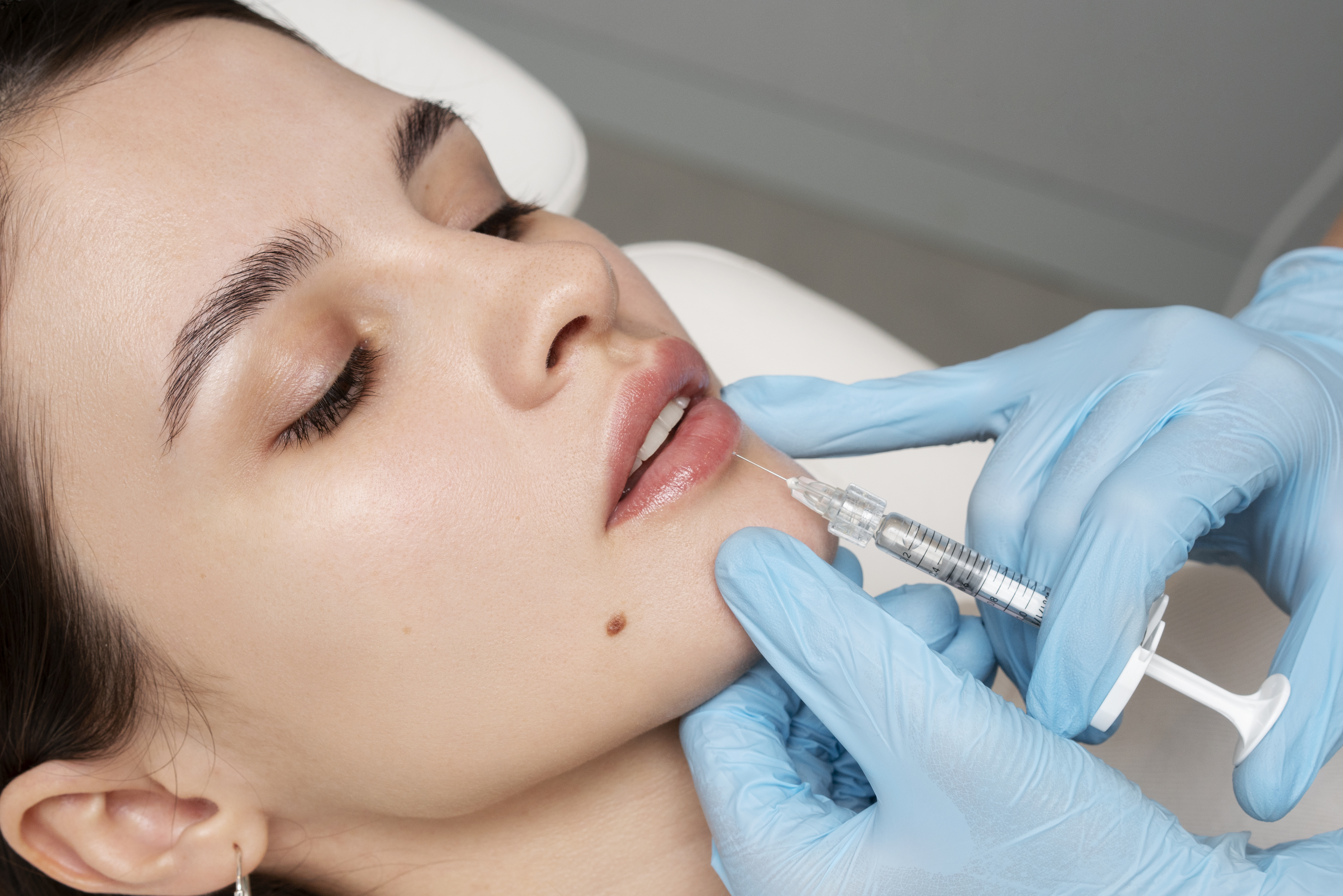 Preenchimento Labial
